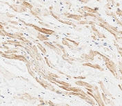 IHC testing of FFPE human heart tissue with MAP1LC3A antibody. HIER: steam section in pH6 citrate buffer for 20 min and allow to cool prior to staining.