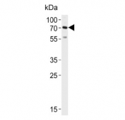 Western blot testing of mouse heart lysate with Hyaluronan synthase 2 antibody. Predicted molecular weight ~64 kDa.