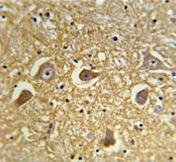 IHC testing of FFPE human brain tissue with Hyaluronan synthase 2 antibody. HIER: steam section in pH6 citrate buffer for 20 min and allow to cool prior to staining.