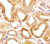 IHC testing of FFPE human kidney tissue with Hyaluronan synthase 2 antibody. HIER: steam section in pH6 citrate buffer for 20 min and allow to cool prior to staining.