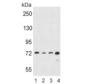 Western blot testing of human 1) HeLa, 2) A549, 3) K562 and 4) MDA-MB-453 cell lysate with ALOX15 antibody. Predicted molecular weight ~75 kDa.
