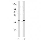 Western blot testing of 1) human fetal heart and 2) mouse heart lysate with NPPA antibody. Predicted molecular weight ~17 kDa.