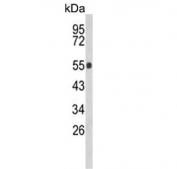 Western blot testing of mouse lung lysate with Glucosylceramidase beta antibody. Predicted molecular weight ~60 kDa.