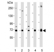 Western blot testing of human 1) 293T, 2) HeLa, 3) LNCaP, 4) MCF7 and 5) U-2 OS cell lysate with Glucosylceramidase beta antibody. Predicted molecular weight ~60 kDa.