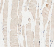 IHC testing of FFPE human skeletal muscle tissue with Glucosylceramidase beta antibody. HIER: steam section in pH6 citrate buffer for 20 min and allow to cool prior to staining.