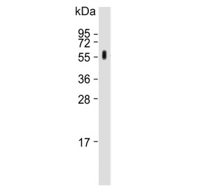 Western blot testing of rat kidney lysate with CYP27B1 antibody. Predicted molecular weight ~57 kDa.