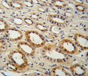 IHC testing of FFPE human kidney tissue with CYP27B1 antibody. HIER: steam section in pH6 citrate buffer for 20 min and allow to cool prior to staining.