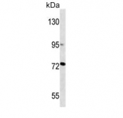 Western blot testing of human T-47D cell lysate with MMP2 antibody. Predicted molecular weight ~72 kDa.