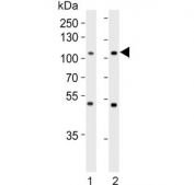 Western blot testing of human 1) HepG2 and 2) MCF7 cell lysate with MAP4K3 antibody. Predicted molecular weight ~101 kDa.