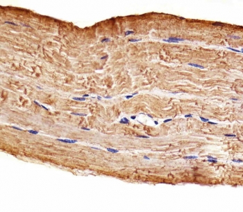 IHC testing of FFPE human skeletal muscle tissue with MAP4K3 antibody. HIER: steam section in pH6 citrate buffer for 20 min and allow to cool prior to staining.~