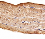 IHC testing of FFPE human skeletal muscle tissue with MAP4K3 antibody. HIER: steam section in pH6 citrate buffer for 20 min and allow to cool prior to staining.