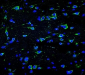 Immunofluorescent staining of brain tissue with Neurofilament-66 antibody (green) and DAPI nuclear stain (blue).