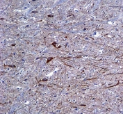 IHC testing of FFPE human brain tissue with Neurofilament-66 antibody. HIER: steam section in pH6 citrate buffer for 20 min and allow to cool prior to staining.