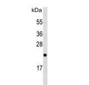 Western blot testing of mouse brain lysate with Rab-23 antibody. Predicted molecular weight: ~27 kDa.