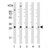 Western blot testing of 1) human brain, 2) mouse brain, 3) human MDA-MB-231, 4) mouse cerebellum and 5) human cerebellum lysate with Rab-23 antibody. Predicted molecular weight: ~27 kDa.
