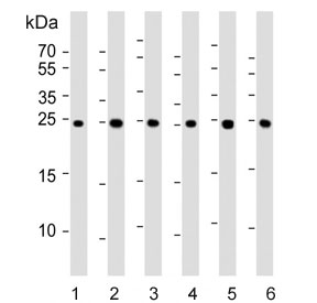 Western blot testing of human 1) liver, 2) HeLa, 3) HepG2, 4) MCF7, 5) mouse Neuro-2a and 6) rat PC-12 cell lysate with PSMA5 antibody. Predicted molecular weight ~26 kDa.