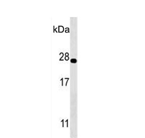 Western blot testing of human K562 cell lysate with PSMA5 antibody. Predicted molecular weight ~26 kDa.