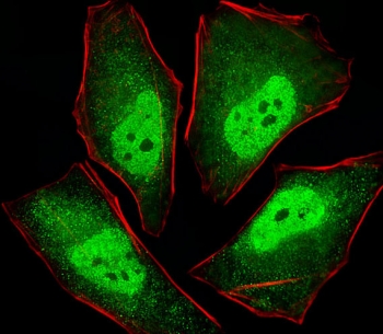 Immunofluorescent staining of human HeLa cells with PSMA5 antibody (green) and anti-Actin (red).