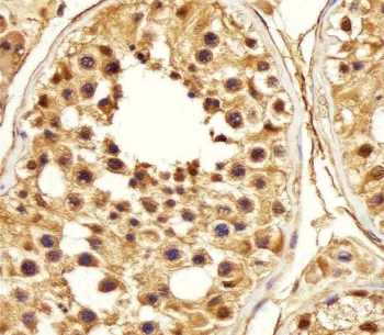 IHC testing of FFPE human testis tissue with PSMA5 antibody. HIER: steam section in pH6 citrate buffer for 20 min and allow to cool prior to staining.