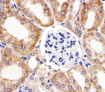 IHC testing of FFPE mouse kidney tissue with BCL10 antibody. HIER: steam section in pH6 citrate buffer for 20 min and allow to cool prior to staining.