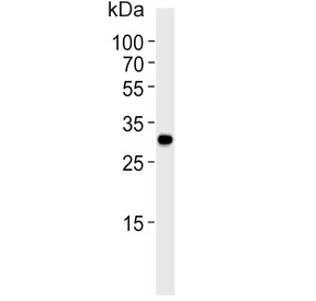 Western blot testing of human Daudi cell lysate with BCL10 antibody. Expected molecular weight: 26~33 kDa.