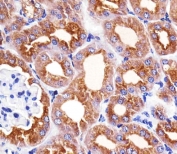 IHC testing of FFPE mouse kidney tissue with Phenylalanine hydroxylase antibody. HIER: steam section in pH6 citrate buffer for 20 min and allow to cool prior to staining.