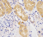 IHC testing of FFPE human kidney tissue with Phenylalanine hydroxylase antibody. HIER: steam section in pH6 citrate buffer for 20 min and allow to cool prior to staining.