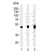 Western blot testing of 1) human HepG2, 2) mouse liver and 3) rat liver lysate with Phenylalanine hydroxylase antibody. Predicted molecular weight ~52 kDa.