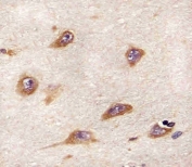 IHC testing of FFPE human brain tissue with ATG4A antibody. HIER: steam section in pH6 citrate buffer for 20 min and allow to cool prior to staining.