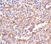 IHC testing of FFPE human spleen tissue with PPP2R1B antibody. HIER: steam section in pH6 citrate buffer for 20 min and allow to cool prior to staining.