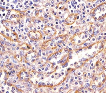 IHC testing of FFPE human spleen tissue with PPP2R1B antibody. HIER: steam section in pH6 citrate buffer for 20 min and allow to cool prior to staining.