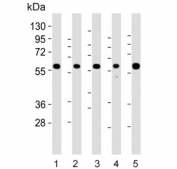 Western blot testing of 1) human Jurkat, 2) human brain, 3) mouse brain, 4) mouse lung and 5) rat brain lysate with PPP2R1B antibody. Predicted molecular weight ~66 kDa.