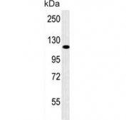 Western blot testing of human K562 cell lysate with POTE2 antibody. Predicted molecular weight ~121 kDa.