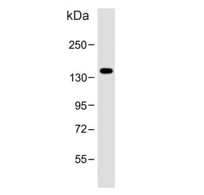 Western blot testing of human LNCaP cell lysate with POTE2 antibody. Predicted molecular weight ~121 kDa.