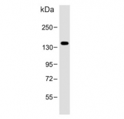 Western blot testing of human LNCaP cell lysate with POTE2 antibody. Predicted molecular weight ~121 kDa.
