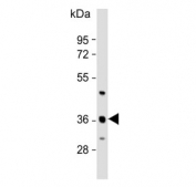 Western blot testing of human liver tissue lysate with C6orf58 antibody. Predicted molecular weight ~40 kDa.