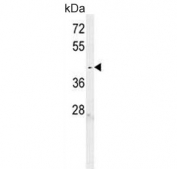 Western blot testing of human K562 cell lysate with C6orf58 antibody. Predicted molecular weight ~40 kDa.