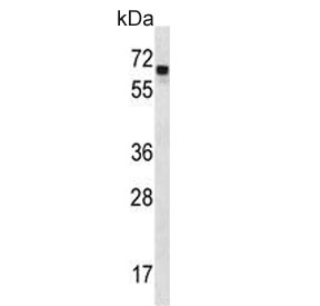 Western blot testing of mouse kidney lysate with Angiopoietin 2 antibody. Predicted molecular weight ~57 kDa.