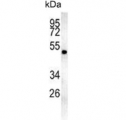 Western blot testing of human K562 cell lysate with MINPP1 antibody. Predicted molecular weight ~55 kDa