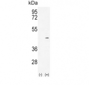 Western blot testing of 1) non-transfected and 2) transfected 293 cell lysate with Alcohol dehydrogenase 4 antibody. Predicted molecular weight ~40 kDa.