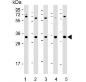 Western blot testing of human 1) HeLa, 2) HCT116, 3) PC-3, 4) SW480 and 5) HUVEC cell lysate with DcR3 antibody. Predicted molecular weight ~33 kDa.