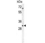 Western blot testing of human HEK293 cell lysate with DcR3 antibody. Predicted molecular weight ~33 kDa.