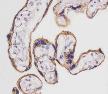 IHC testing of FFPE human placental tissue with SLC3A2 antibody. HIER: steam section in pH6 citrate buffer for 20 min and allow to cool prior to staining.