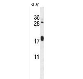 Western blot testing of human A375 cell lysate with ARL8A antibody. Predicted molecular weight ~21 kDa.