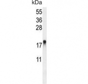 Western blot testing of mouse NIH 3T3 cell lysate with ARL8A antibody. Predicted molecular weight ~21 kDa.