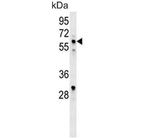 Western blot testing of human CEM cell lysate with IKAROS antibody. Predicted molecular weight ~58 kDa.