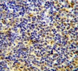 IHC testing of FFPE human tonsil tissue with IKAROS antibody. HIER: steam section in pH6 citrate buffer for 20 min and allow to cool prior to staining.