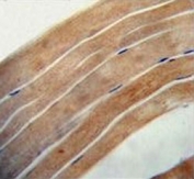 IHC testing of FFPE human skeletal muscle tissue with EFL1 antibody. HIER: steam section in pH6 citrate buffer for 20 min and allow to cool prior to staining.