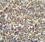 IHC testing of FFPE human lymph tissue with DENND1B antibody. HIER: steam section in pH6 citrate buffer for 20 min and allow to cool prior to staining.