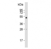 Western blot testing of human MOLT4 cell lysate with DENND1B antibody. Predicted molecular weight: 34~87 kDa (multiple isoforms).